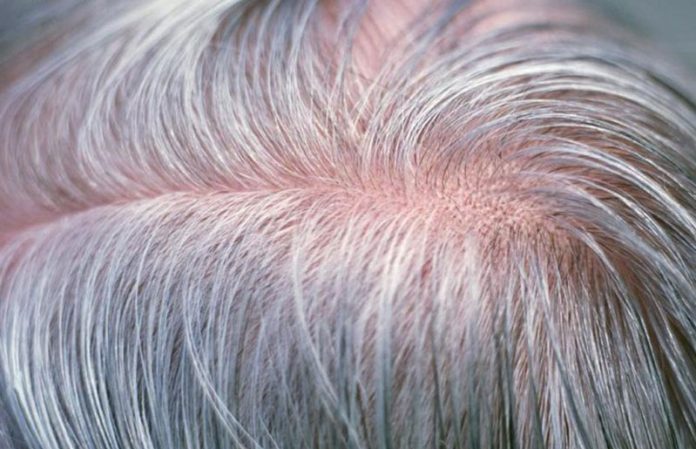 10 nguyên nhân và thói quen khiến tóc bạc sớm