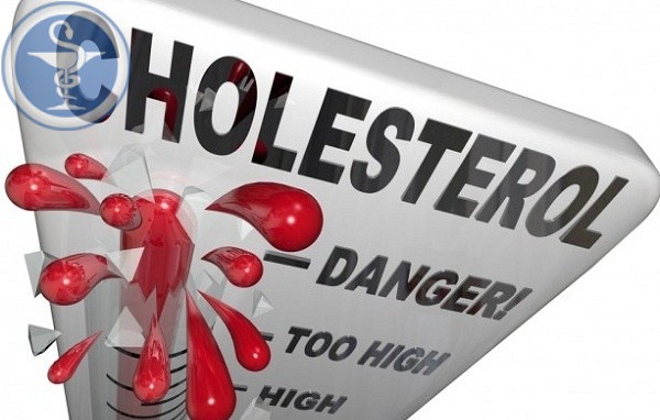 Cholesterol cao có thể gây xơ vữa động mạch