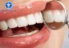 Những cảnh báo về bệnh răng miệng có thể bạn chưa biết Những cảnh báo về bệnh răng miệng có thể bạn chưa biết