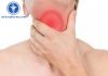 Bệnh viêm họng hạt là gì và cách chữa trị hiệu quả tại nhà Viêm họng hạt là gì?