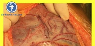 Hướng dẫn thực hành lâm sàng dựa trên bằng chứng trường hợp nhau bám bất thường