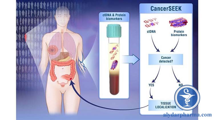 Cancerseek đang được phát triển tại Bệnh viện Hopkins. Vẫn còn một quãng đường dài để có thể đưa đến hiệu quả thực tế trong lâm sàng.