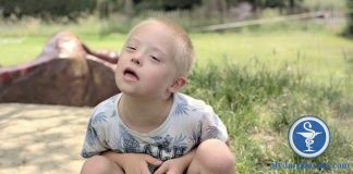 Hội chứng Down (ảnh minh họa một trẻ mắc hội chứng Down)