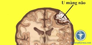 U màng não: phân loại, chẩn đoán và thái độ điều trị