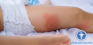 Làm thế nào để phân biệt các bệnh vảy nến, chàm và viêm da cơ địa?