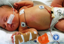 Phòng ngừa Streptococcus nhóm B khởi phát sớm ở trẻ sơ sinh
