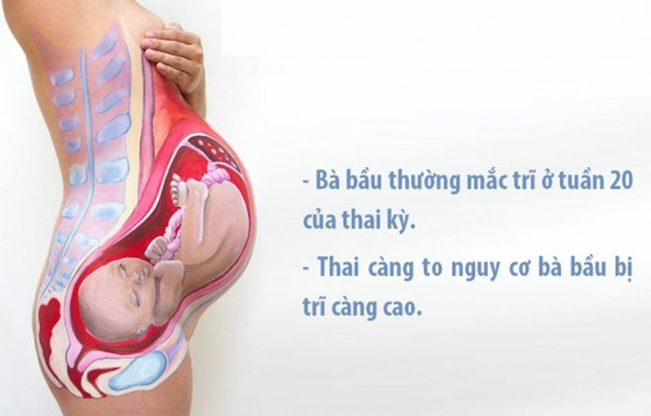 Top gel bôi trĩ cho bà bầu